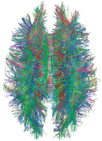 Illustration of a brain network (connectome): the target is the network in which the symptom arises.